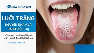 Dưới Lưỡi Là Bộ Phận Gì