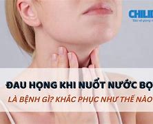 Nuốt Nướng Miếng Đau Họng